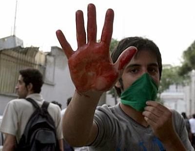 Jovem pró-Mousavi mostra mão ensanguentada durante protestos em Teerã