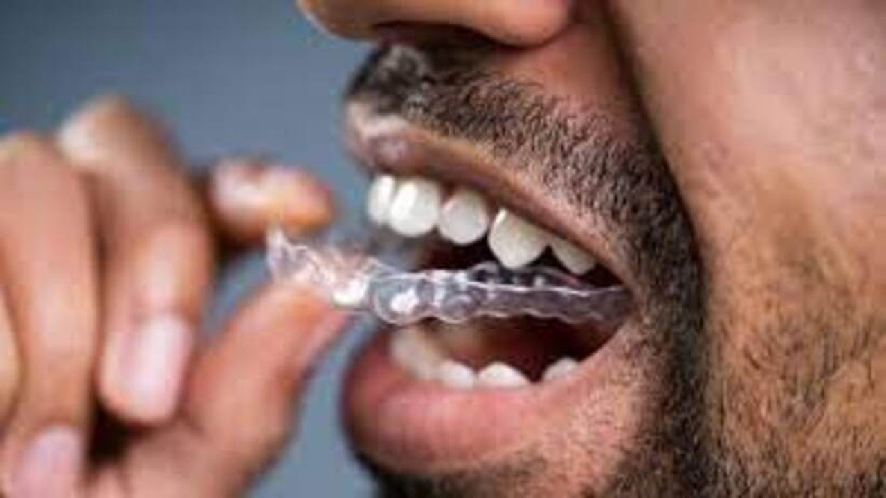 Bruxismo: Hábito de ranger os dentes pode causar vários prejuízos, mas há tratamento