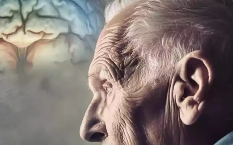 Como a perda da audição e da visão depois dos 65 anos eleva o risco de demência