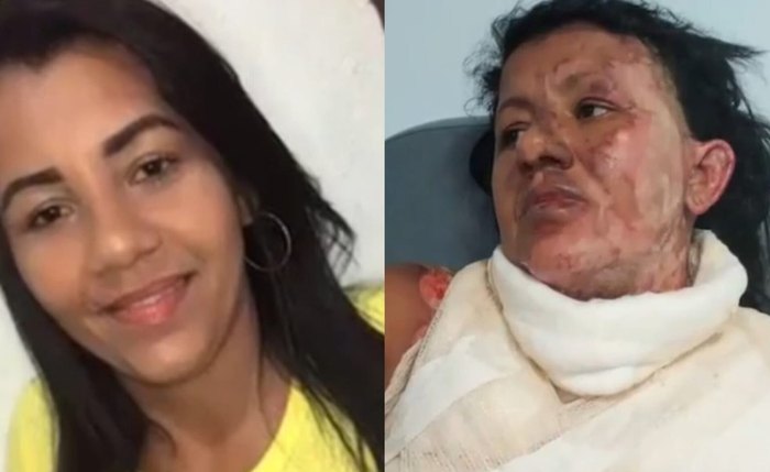 Claudiane antes e depois do incêndio