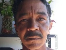 Morre sobrevivente do acidente com Césio-137 em Goiás, irmão de Leide das Neves