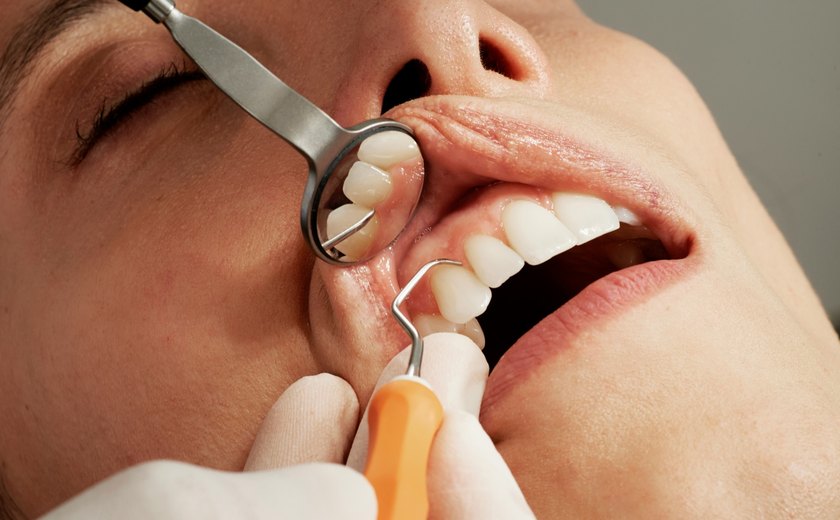 Cuidar da saúde bucal pode evitar complicações de doenças associadas