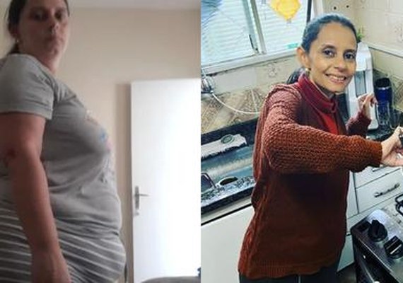 Caso raro faz com que mulher precise reverter bariátrica após chegar aos 36kg