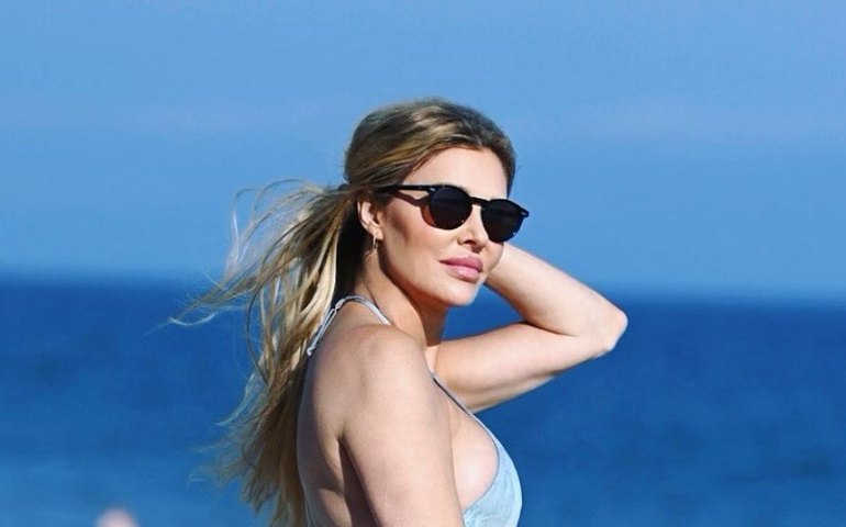 Ex-modelo internacional pede ajuda após rosto 'derreter': 'O que está acontecendo?'