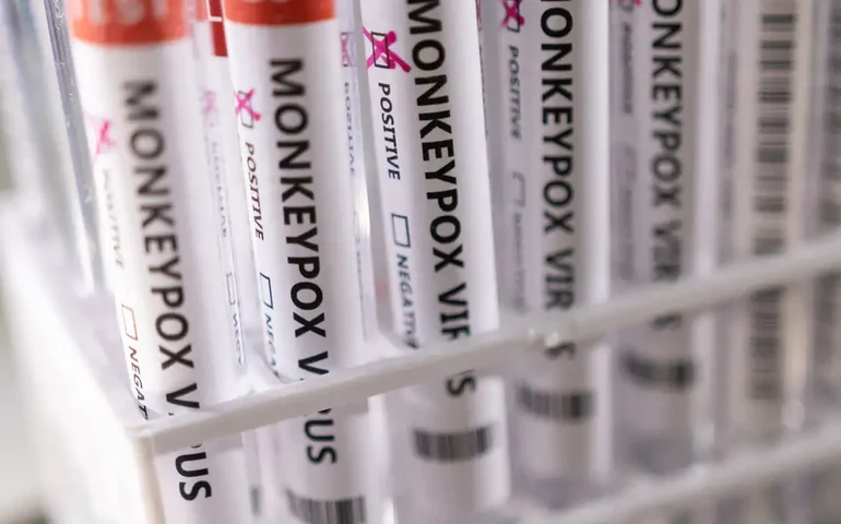 Por que a varíola foi erradicada e a mpox não? 