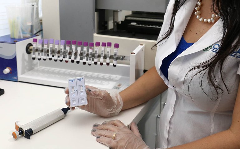 Cruzeiro diz que primeiros testes para covid-19 tiveram resultados negativos