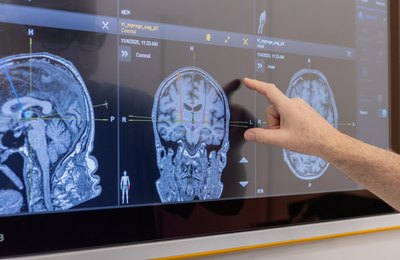 Telemedicina resolve 98% dos casos na atenção primária e reduz espera por especialistas no Rio Grande do Norte