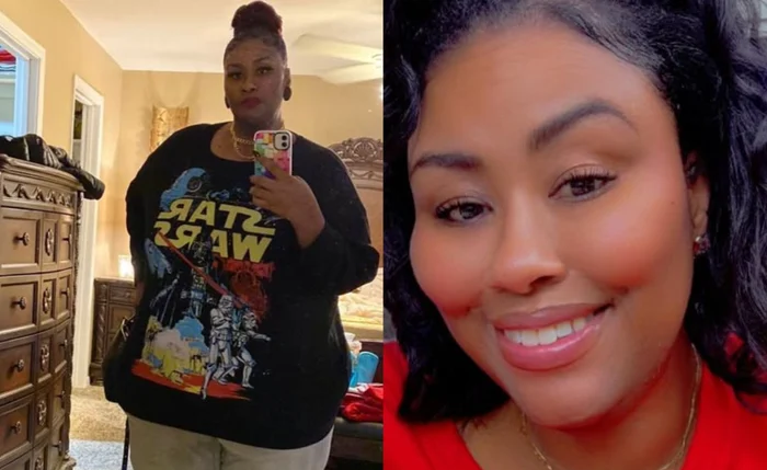 Octavia Nichelle perdeu mais de 100 kg após tratamento com o Dr. Now