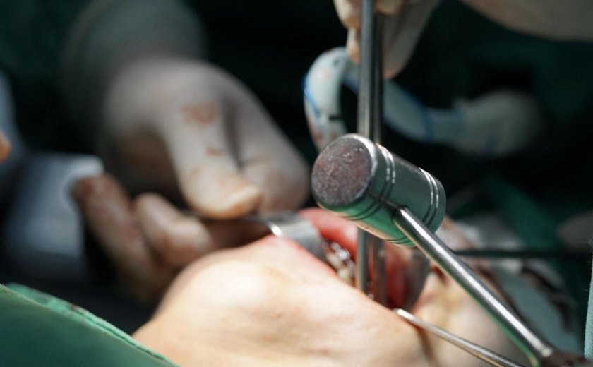 Hospital Regional do Norte é o primeiro da Rede Hospitalar Pública do Estado a realizar a cirurgia ortognática