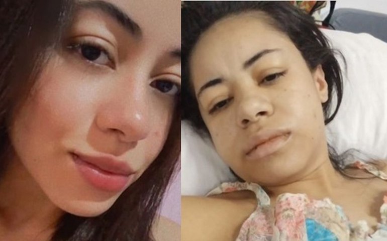 Jovem alagoana precisa de ajuda para custear tratamento de doença rara