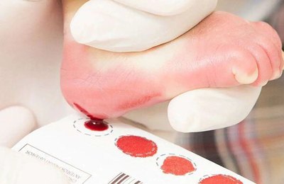 Dia Nacional do Teste do Pezinho: Campanha conscientiza população sobre a importância do exame 