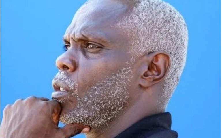 'Minha cabeça agora está legal. Antes, estava terrível', diz Cláudio Adão sobre luta contra o Parkinson