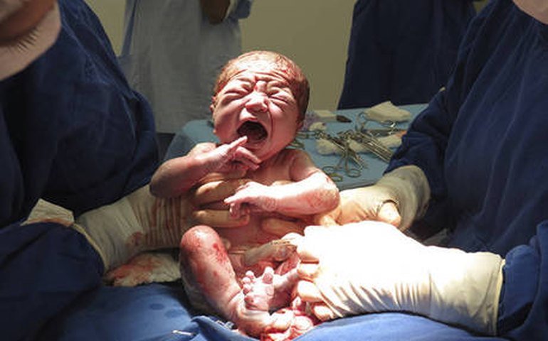 Maternidades do SUS passam a ter novas regras para parto humanizado