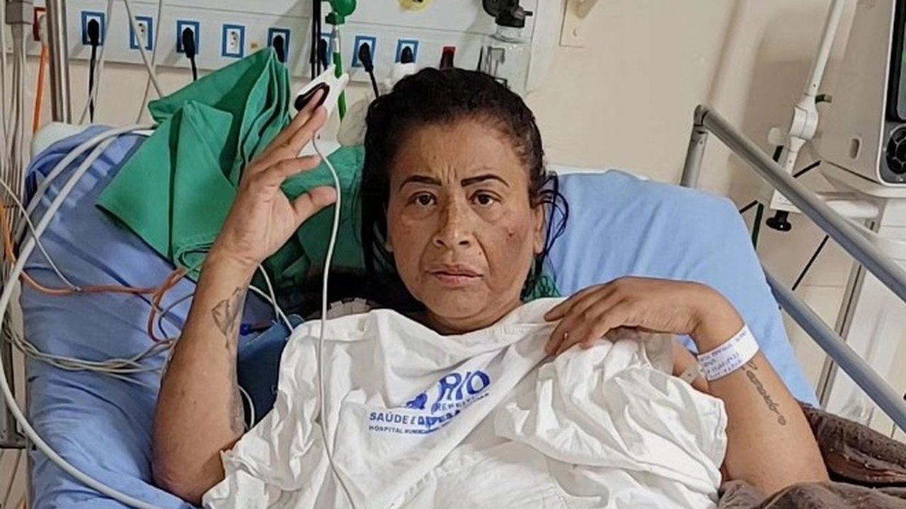 Mc Katia passa por segunda amputação devido a complicações de cirurgia