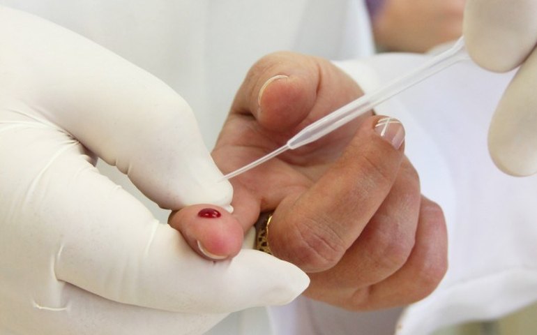 Espírito Santo vai fazer teste de anticorpos da covid-19 em 30 mil pessoas