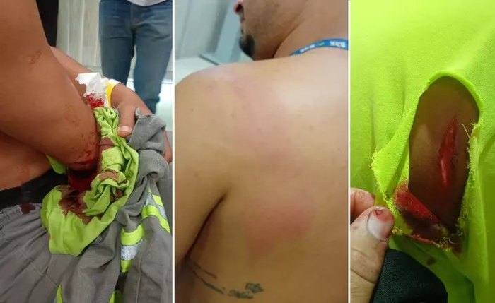 Trabalhadores da BRK ficaram feridos após ataque de homem em função da suspensão do abastecimento