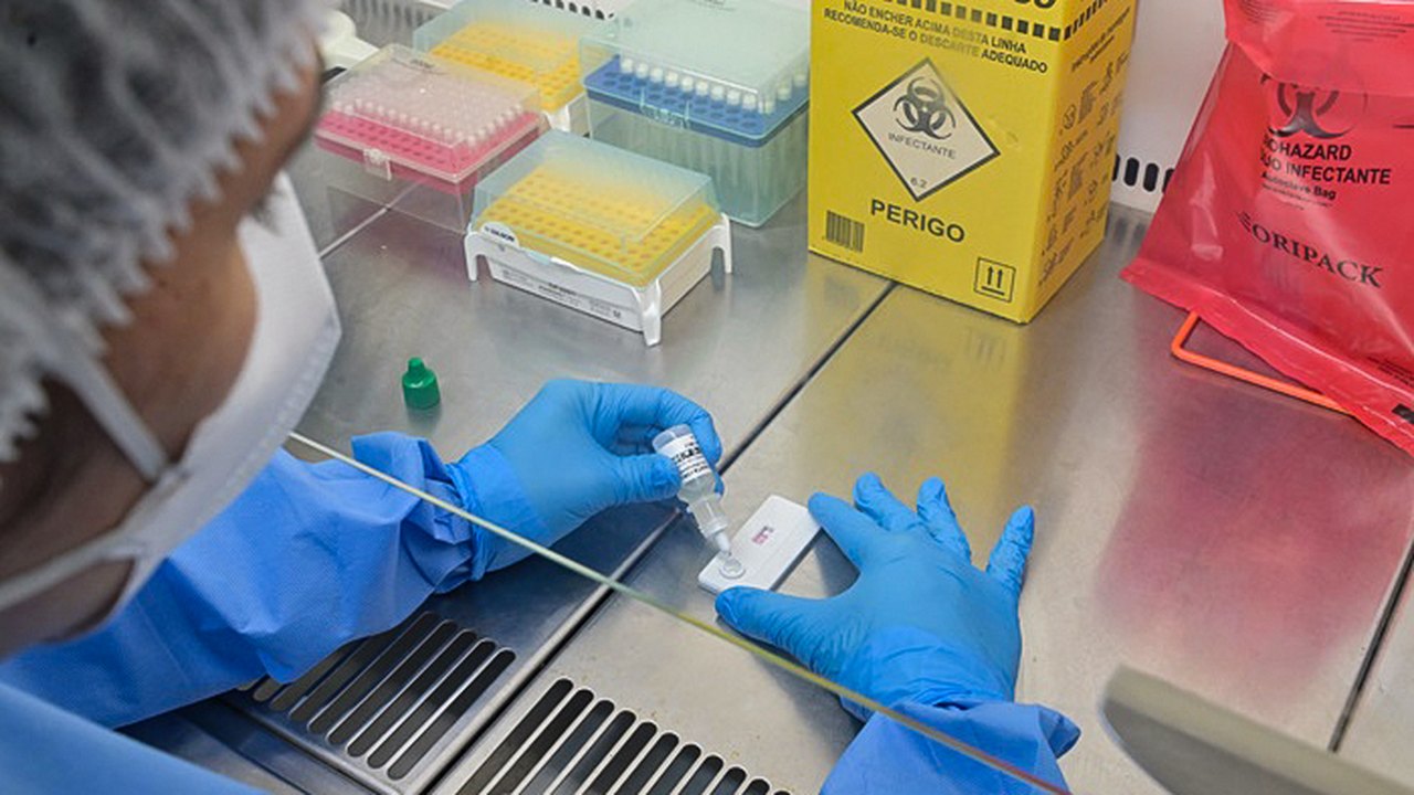 Anvisa atualiza regras sobre controle de qualidade em laboratórios