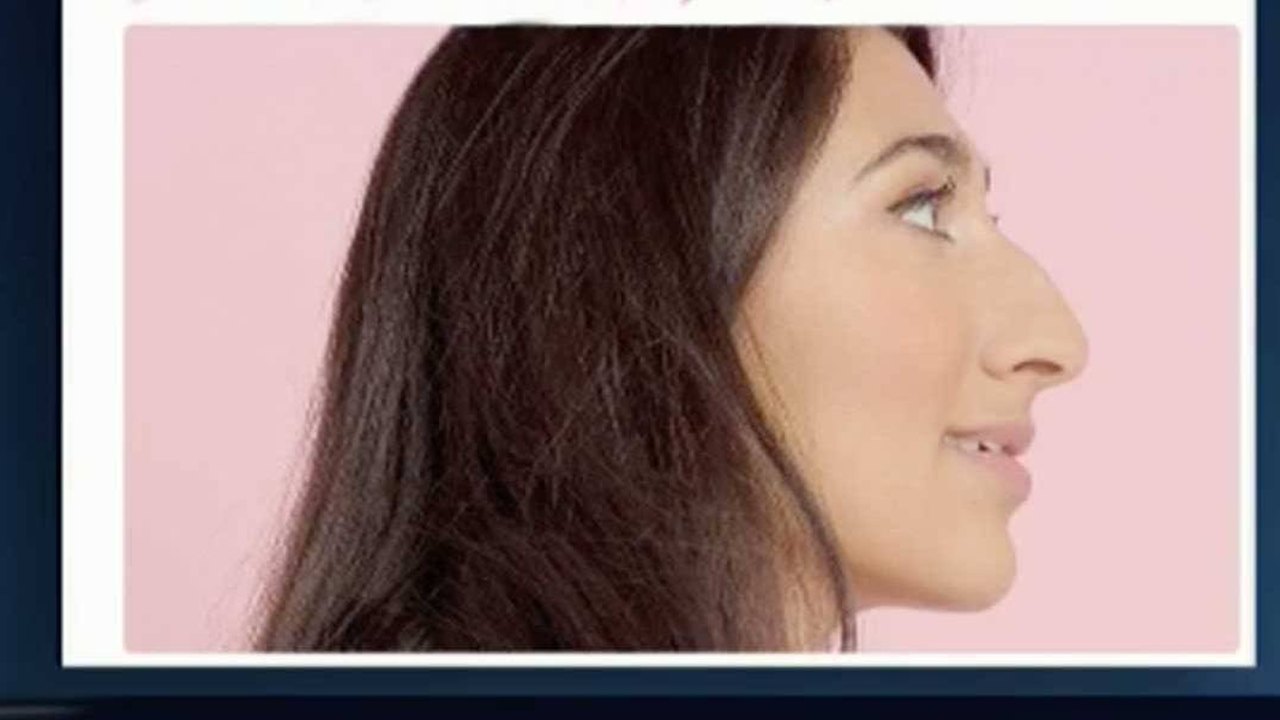 Selfies fazem nariz parecer 30% mais largo, aponta estudo