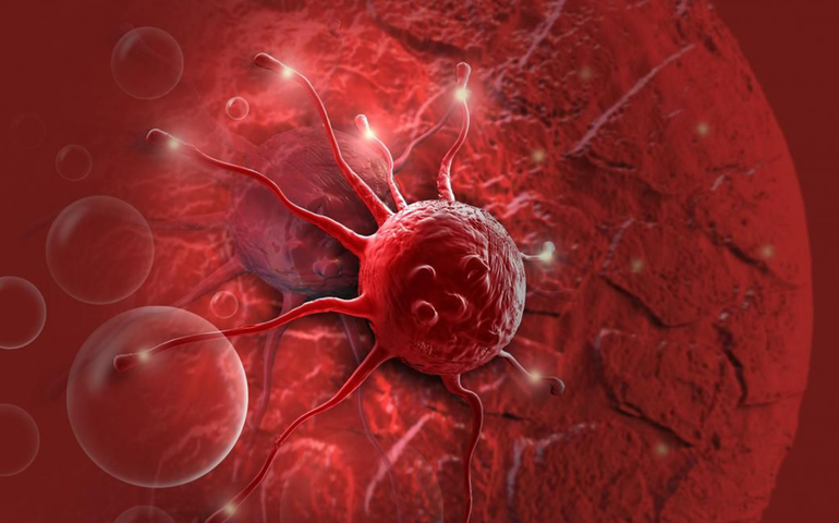 Ásia concentra quase metade dos casos de câncer no mundo