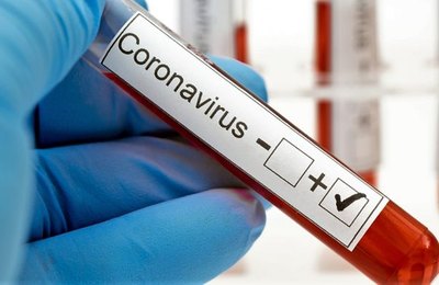 Serviço de Verificação de Óbito registra mais duas mortes por Covid-19 em Penedo