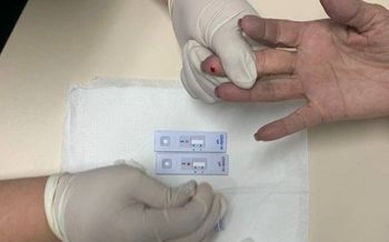 Prefeitura irá realizar testes rápidos para covid-19 na população de Arapiraca