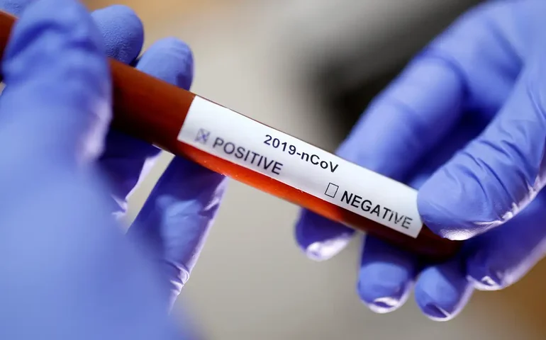 Mais de 700 mil mortos: Memorial é inaugurado no Rio em homenagem às vítimas da Covid-19