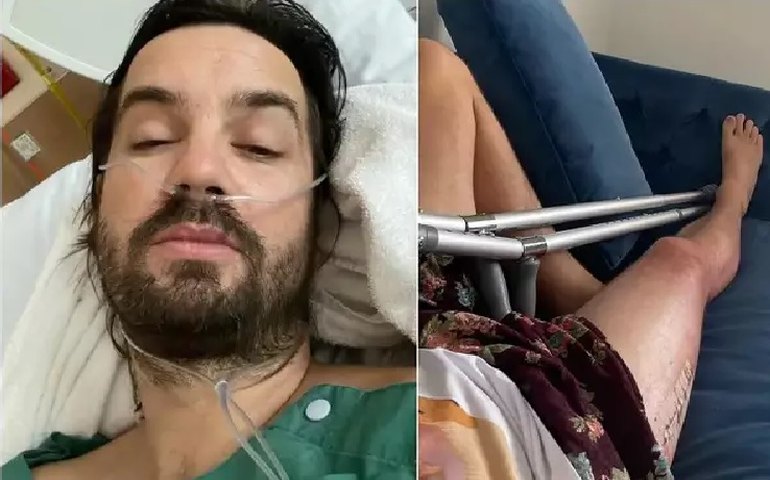 Vocalista da banda Tame Impala, Kevin Parker fratura o quadril