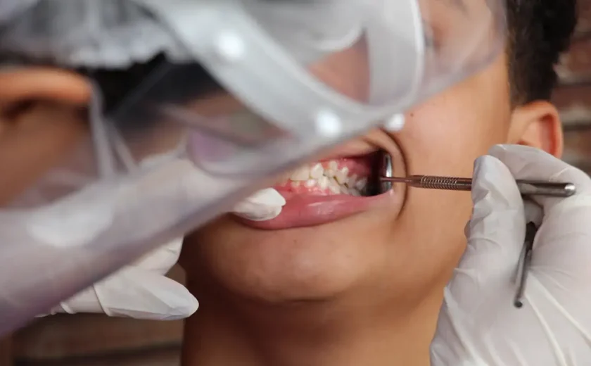 O que é a brancorexia, novo distúrbio da obsessão dos dentes claros