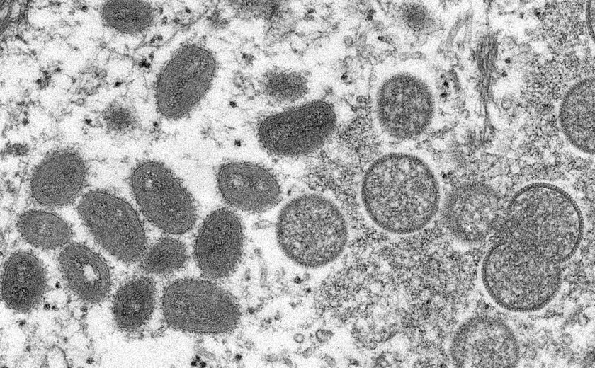 Brasil tem diagnosticado terceiro caso de varíola dos macacos