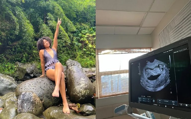 Naomi Osaka anuncia gravidez: &#8216;Momentos de desafio podem ser os mais divertidos&#8217;