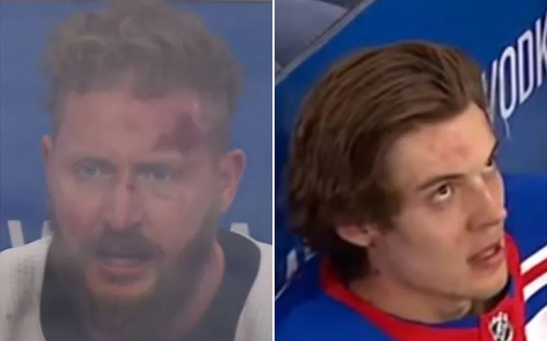 Vídeo: jogadores de hóquei trocam socos durante partida; entenda regra que ‘permite’ brigas