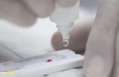 SEMS Penedo atualiza boletim epidemiológico Covid-19