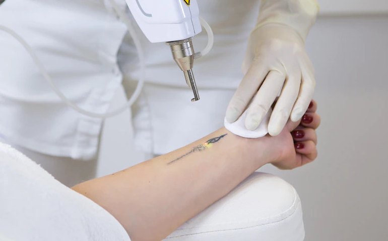 Procedimentos estéticos a laser podem trazer riscos à saúde