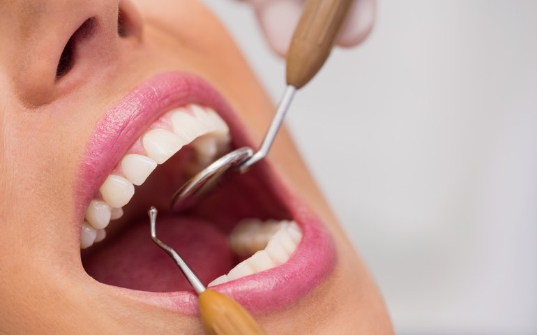 Atenção à saúde bucal pode evitar doenças