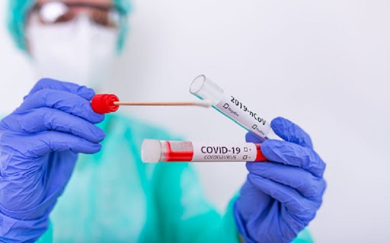 Para conter nova onda de covid, governo do Rio quer criar postos de diagnóstico