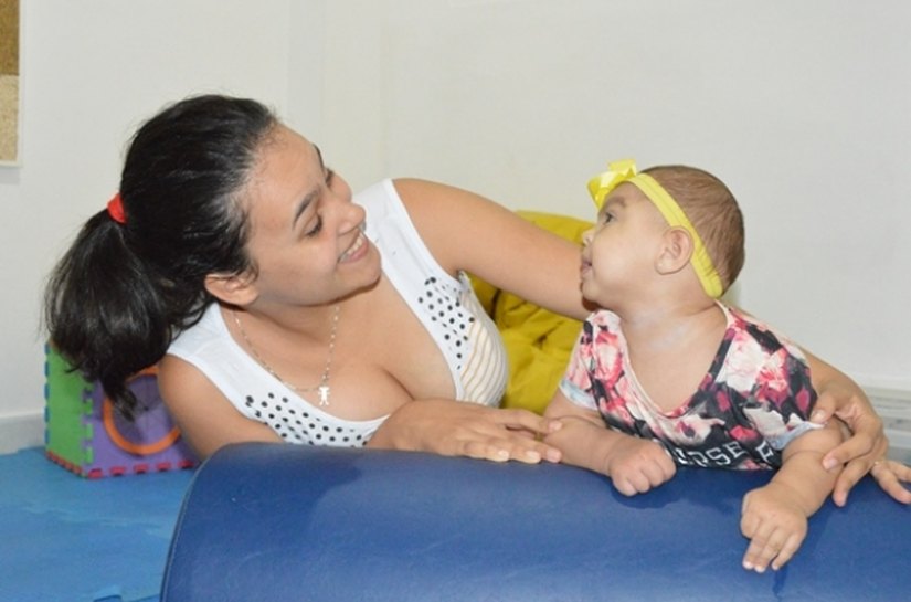 Sesau oferece atendimento humanizado a crianças com microcefalia