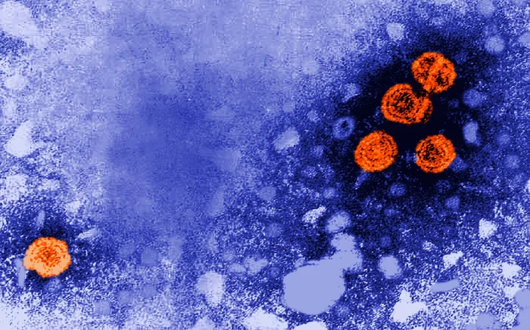 Medicamento experimental contra hepatite B pode oferecer 'cura funcional' para alguns pacientes.