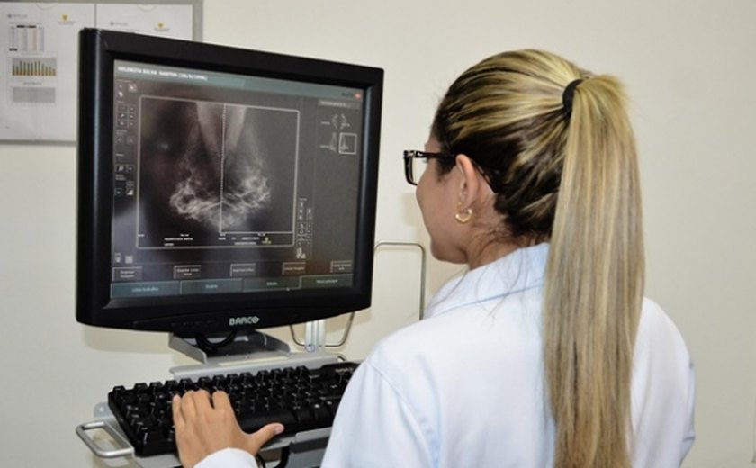 Cresce o número de mamografias realizadas pelo SUS em Alagoas
