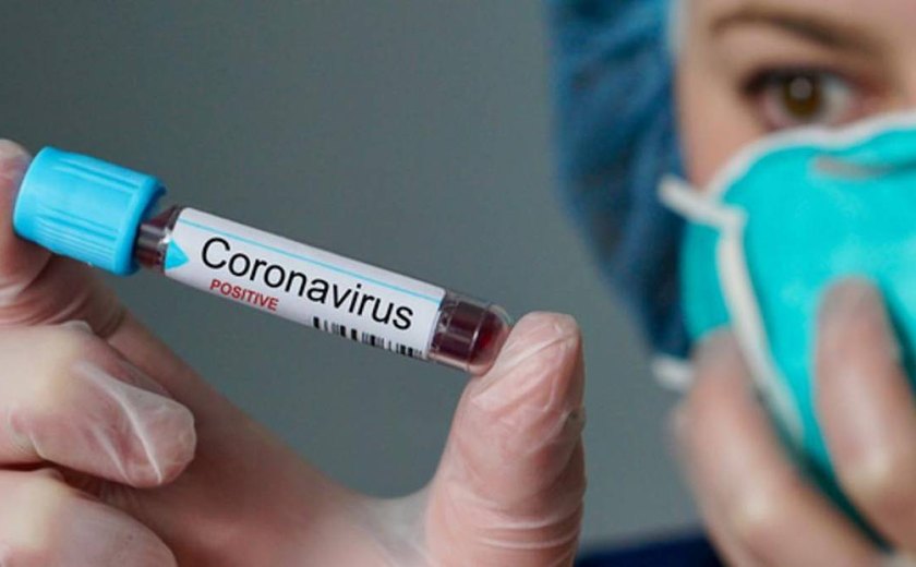 Sobe para 25 o número de infectados por coronavírus em Palmeira