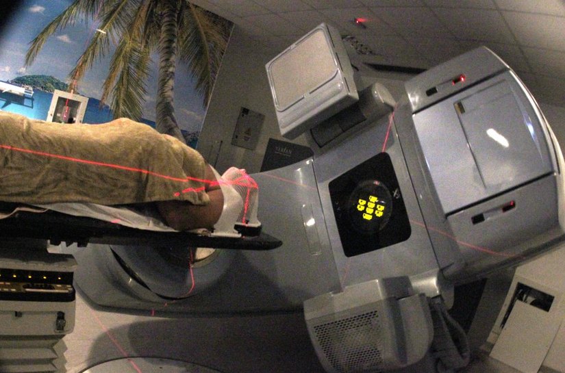 Santa Casa de Maceió oferece tratamento completo e individualizado para câncer de pulmão