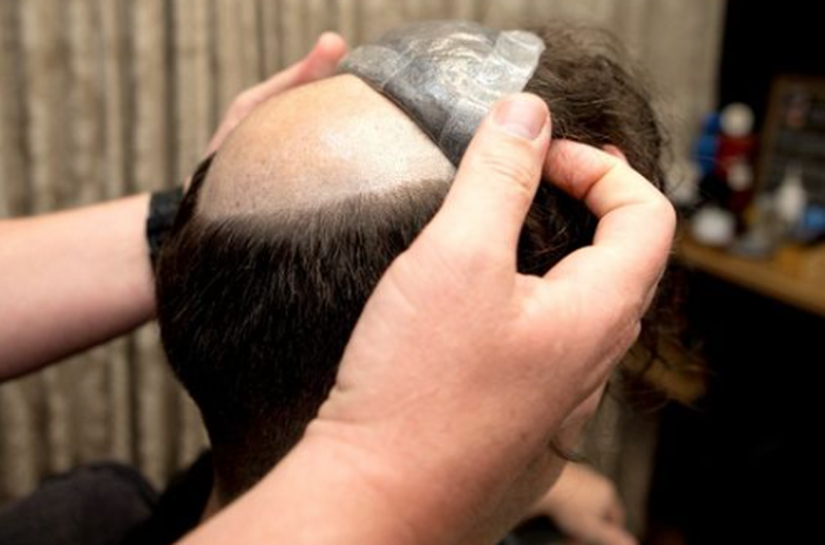 Prótese Capilar Masculina ganha espaço e chega ao Elder Farias Hair Salon como aposta de inovação