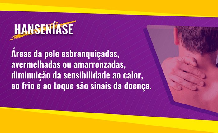 Apenas no ano passado, Alagoas registrou 334 casos novos da doença, 50% deles na forma mais avançada