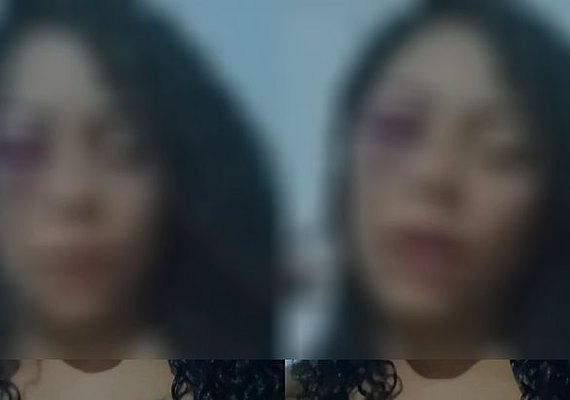 Mulher denuncia agressão de ex-companheiro por não aceitar término