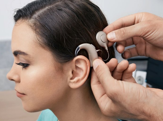 Implante coclear: quem pode fazer a cirurgia que devolve a audição