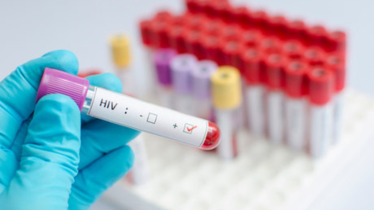 Universidade brasileira relata tratamento que elimina HIV de paciente