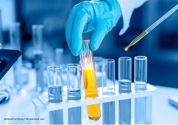 Produção de químicos de uso industrial sobe 11,26% em junho, diz Abiquim