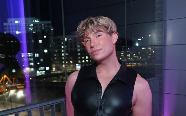 Ex-BBB finlandês fica temporariamente cego após cirurgia plástica