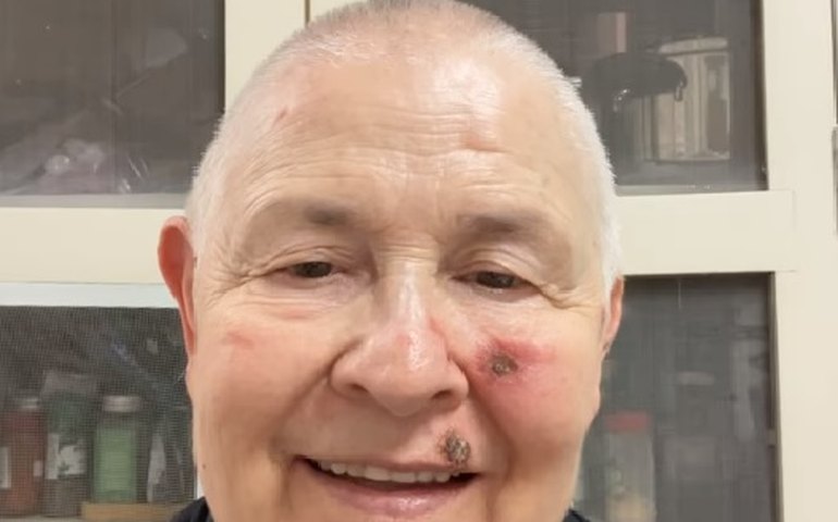 Monja Coen revela que está com câncer e transmite mensagem de esperança