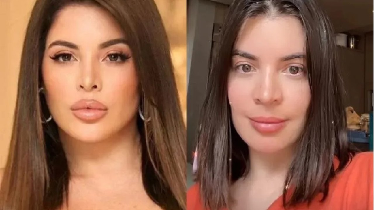 Gkay divulga fotos após retirar preenchimento dos lábios
