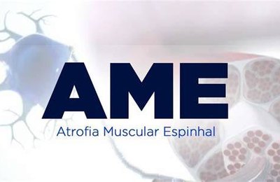 AME tipo III: condição afeta 35% dos pacientes jovens e adultos no mundo